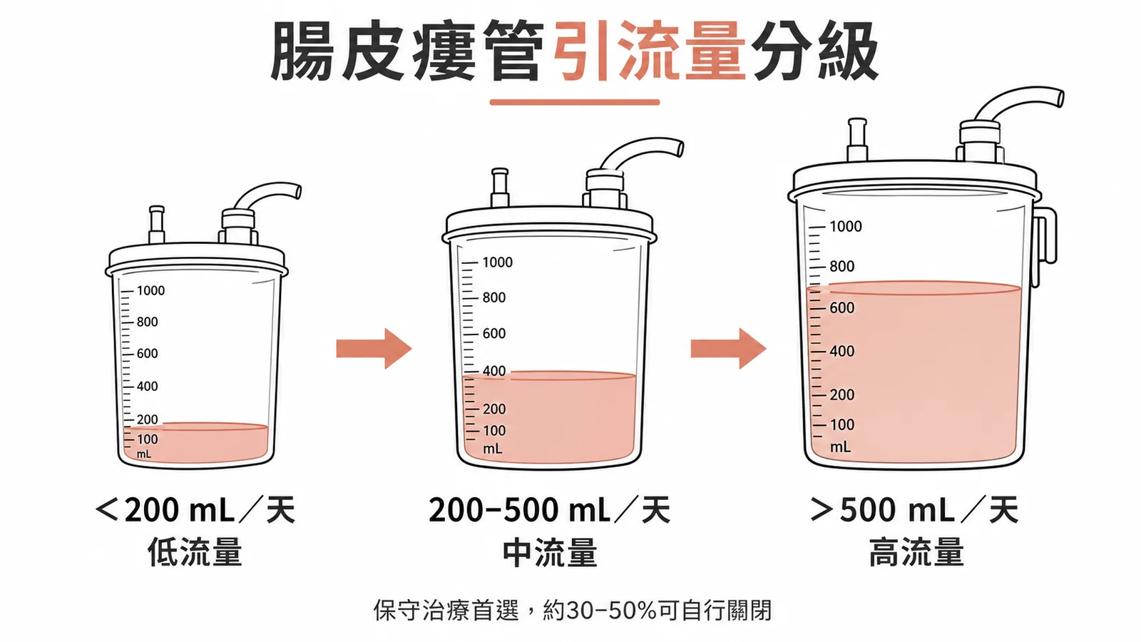 腸皮瘻管引流量分級:低流量<200、中流量200-500、高流量>500 mL/天