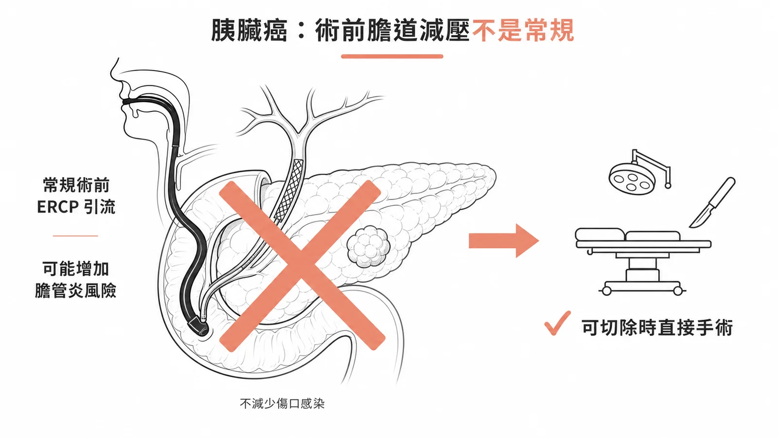 胰臟癌術前膽道減壓非常規:不減少傷口感染