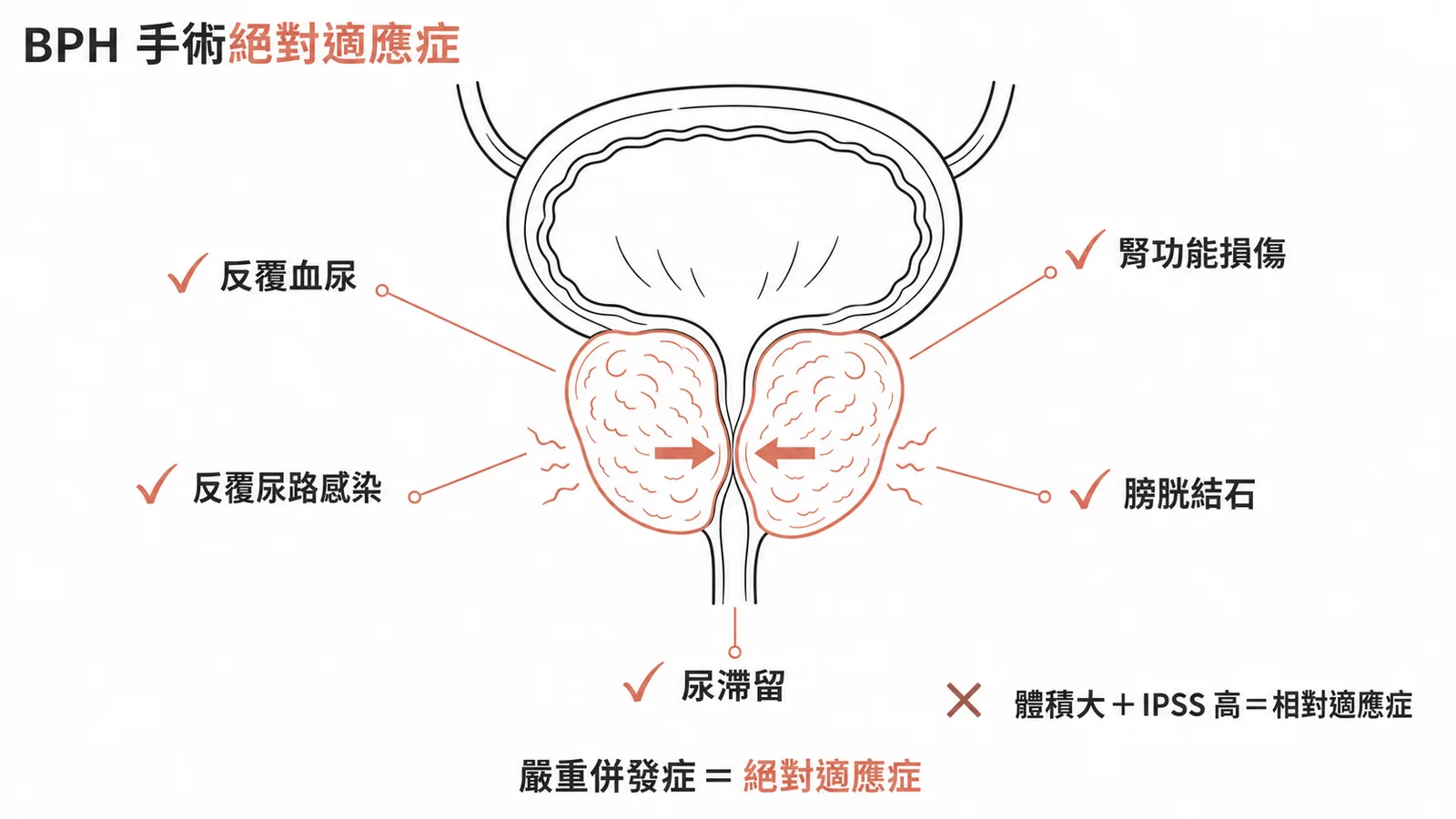 BPH手術絕對適應症:嚴重併發症(血尿、感染、腎損傷)vs 相對適應症(體積大+IPSS高)