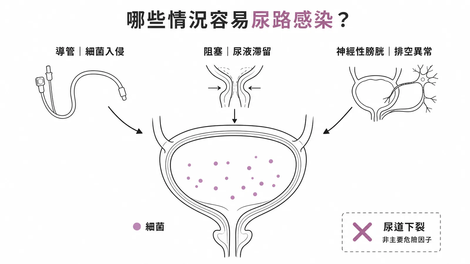 尿路感染三大危險因子與尿道下裂的區別