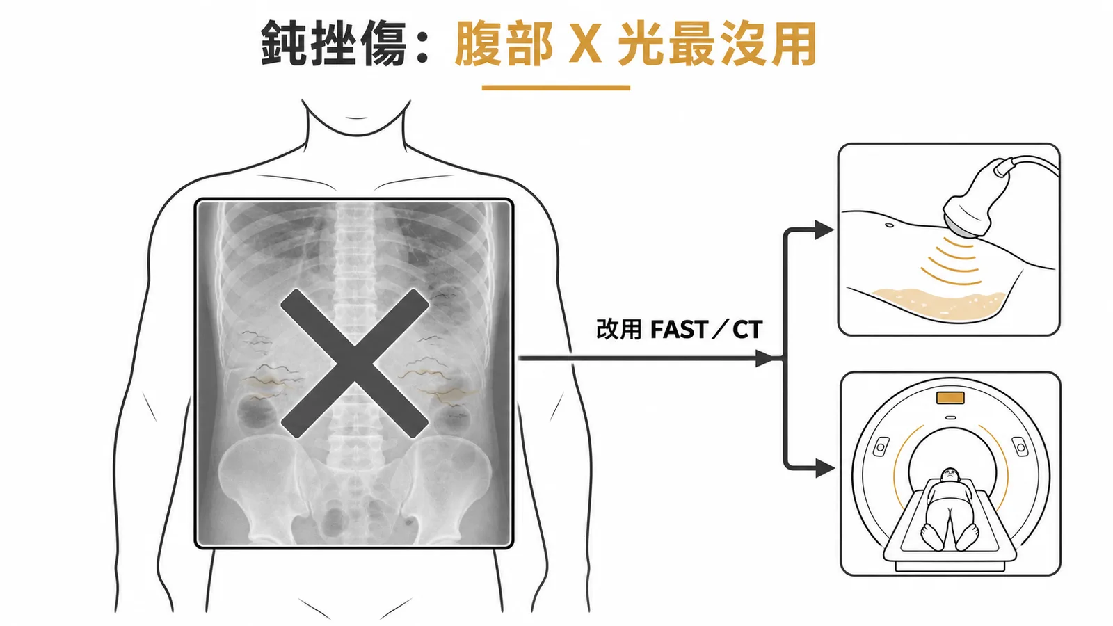 鈍挫傷急診評估：腹部X光對內臟損傷幫助最小，應改用FAST超音波或CT