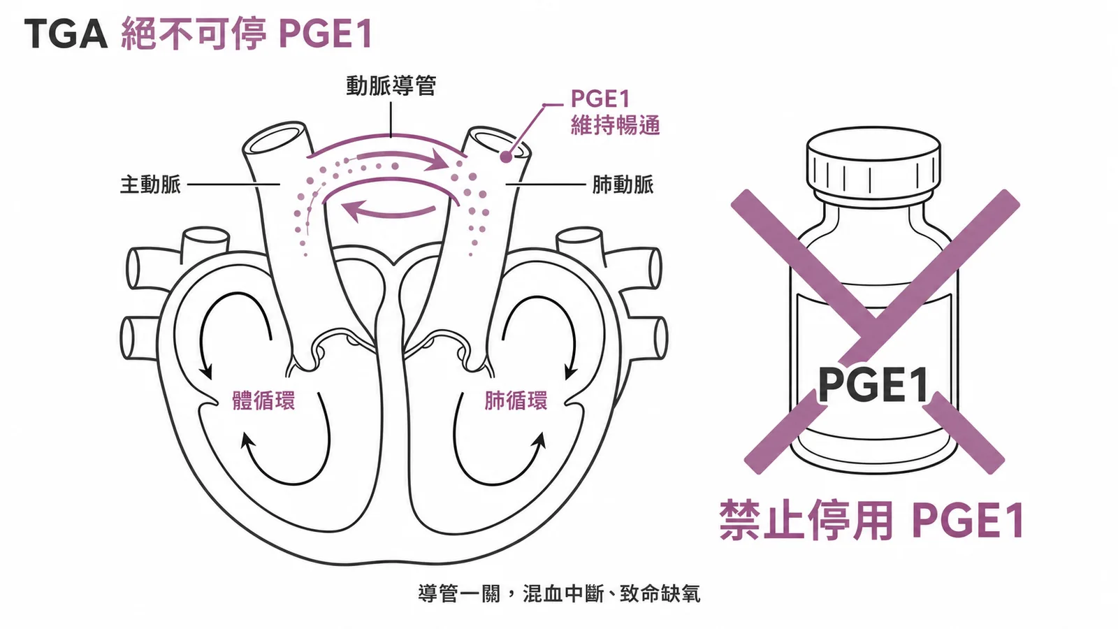 TGA新生兒絕不可停PGE1的示意圖