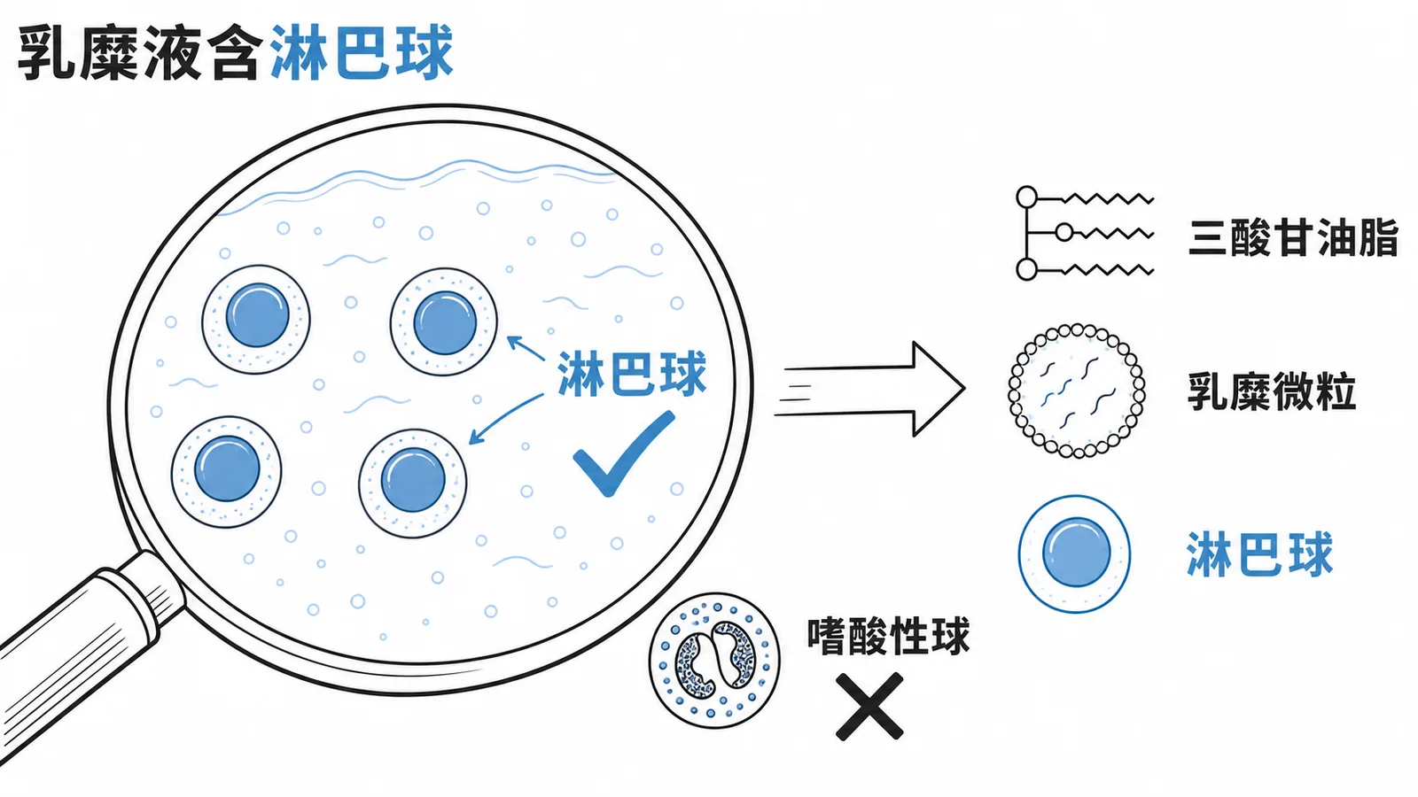 乳糜液細胞成分是淋巴球而非嗜酸性球的示意圖