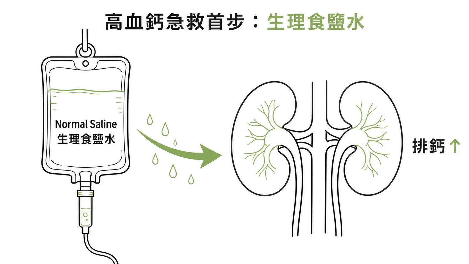 高血鈣急救首步是生理食鹽水靜脈補液促進腎臟排鈣