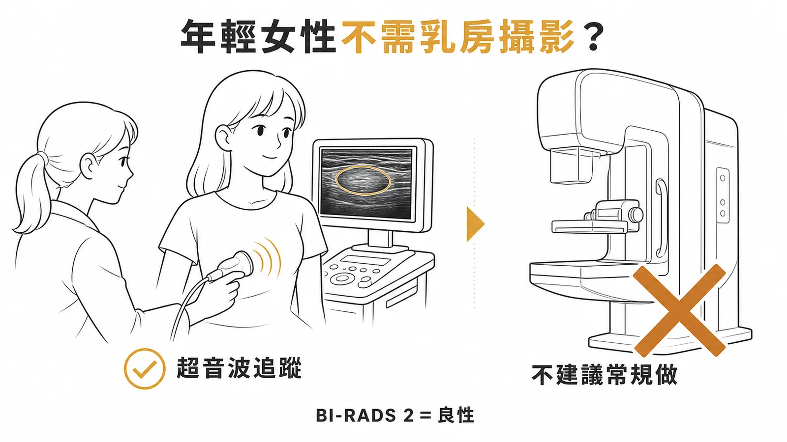 年輕女性 BI-RADS 2 良性病灶：超音波追蹤即可，不建議常規乳房攝影