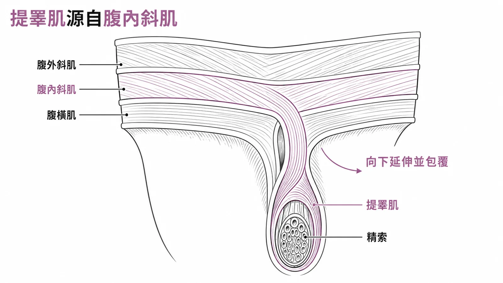 提睪肌是腹內斜肌的延伸，包覆精索外圍