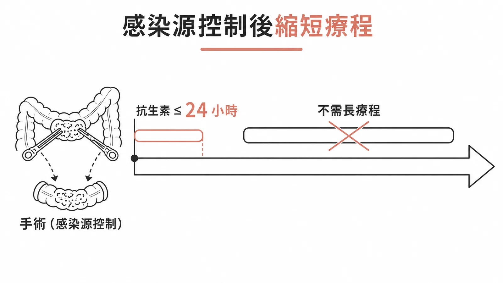腹內感染源控制後抗生素療程應縮短至24小時內的示意圖