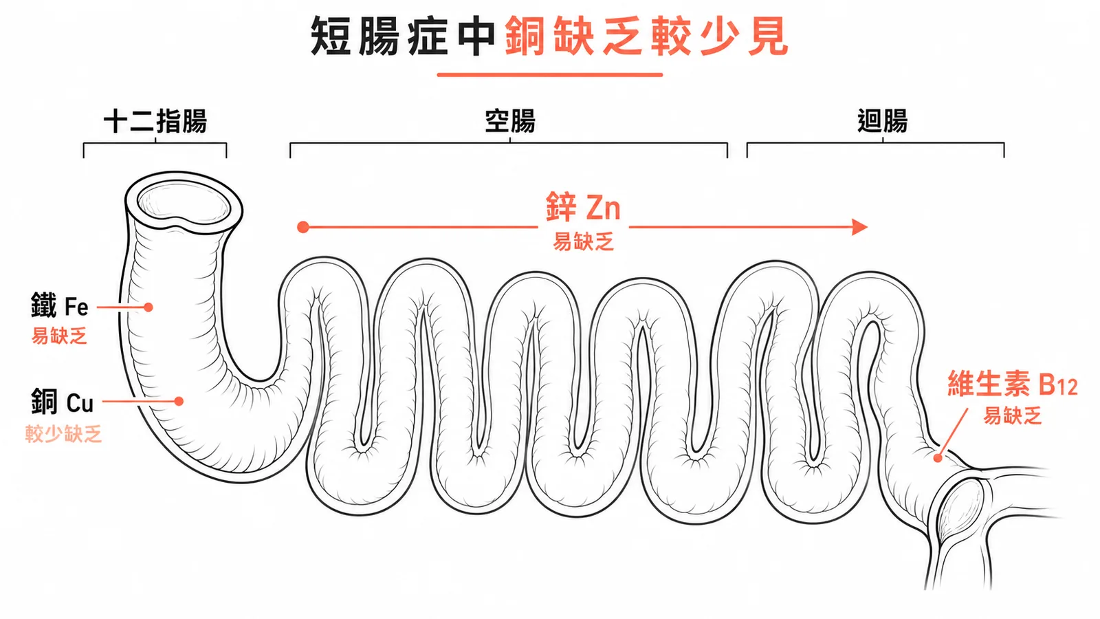 短腸症中各微量元素吸收部位與銅缺乏較少見的示意圖