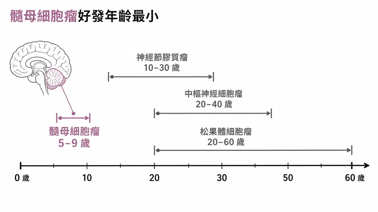 四種腦腫瘤好發年齡比較圖髓母細胞瘤最小