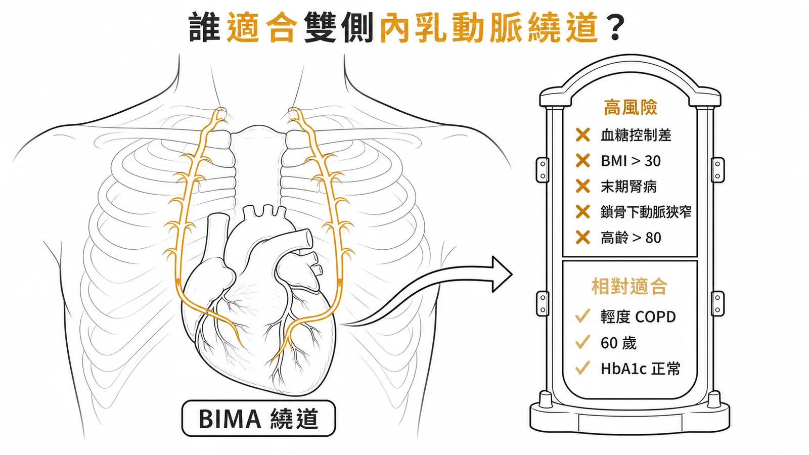 雙側內乳動脈繞道手術適合與不適合的風險因子