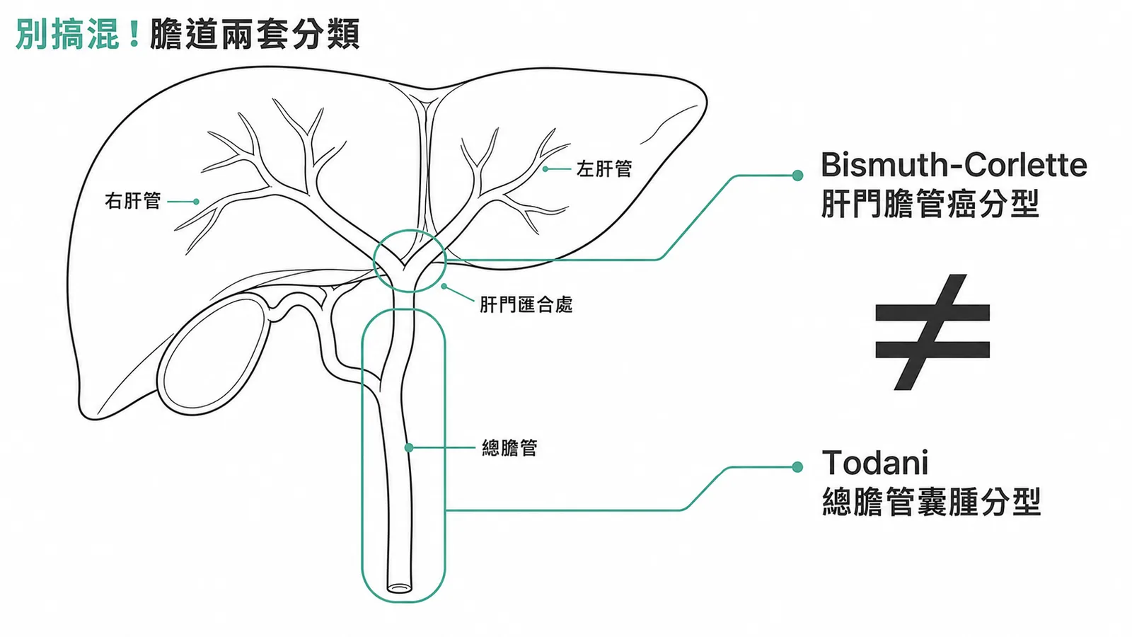 膽道兩套分類：Bismuth-Corlette=肝門膽管癌、Todani=總膽管囊腫