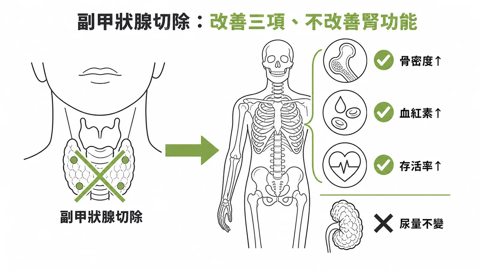 副甲狀腺切除後可改善骨密度、血紅素與存活率，但腎功能已不可逆，尿量不會改善
