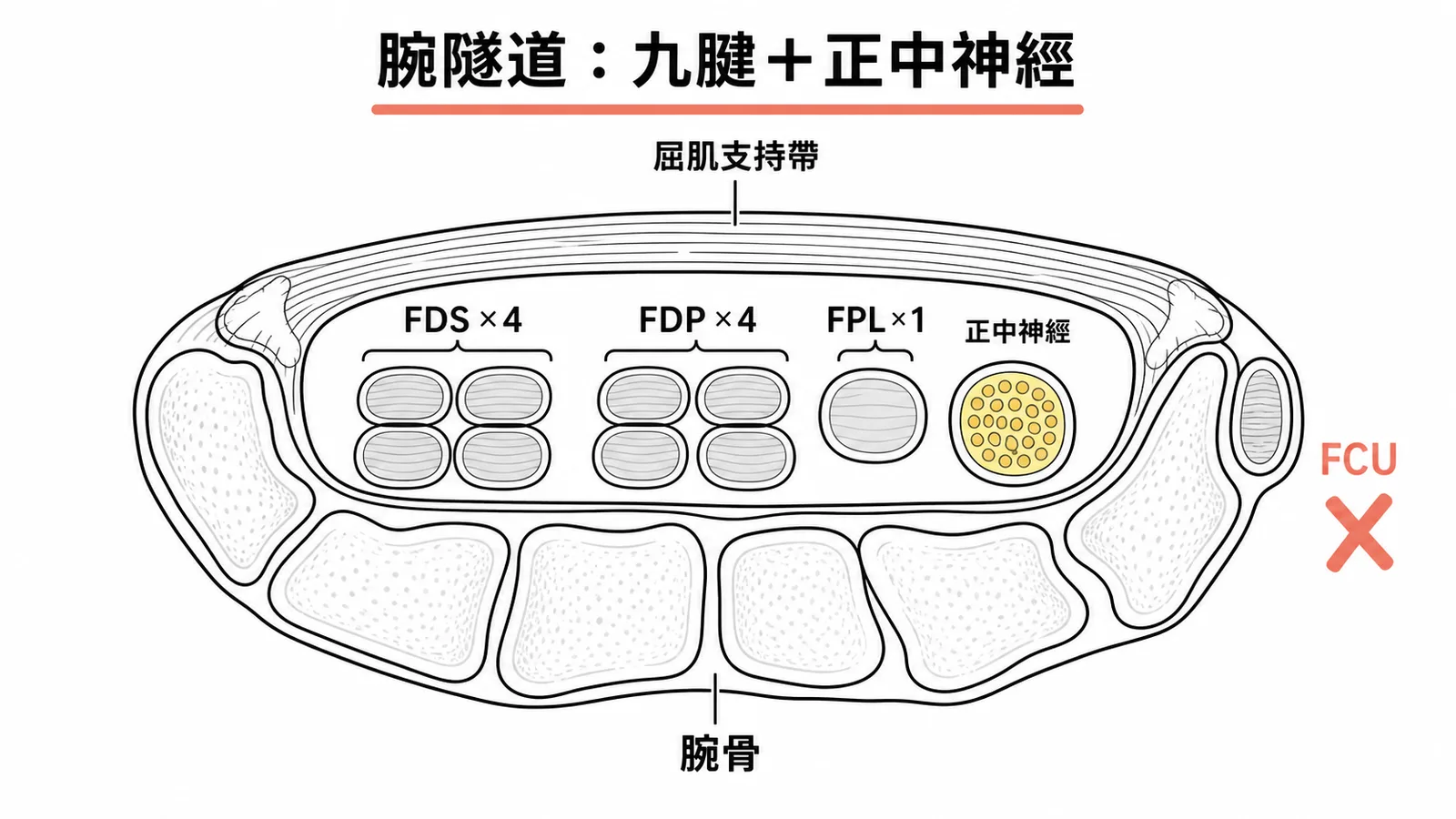 腕隧道橫切面示意圖:九條肌腱加正中神經,FCU在隧道外