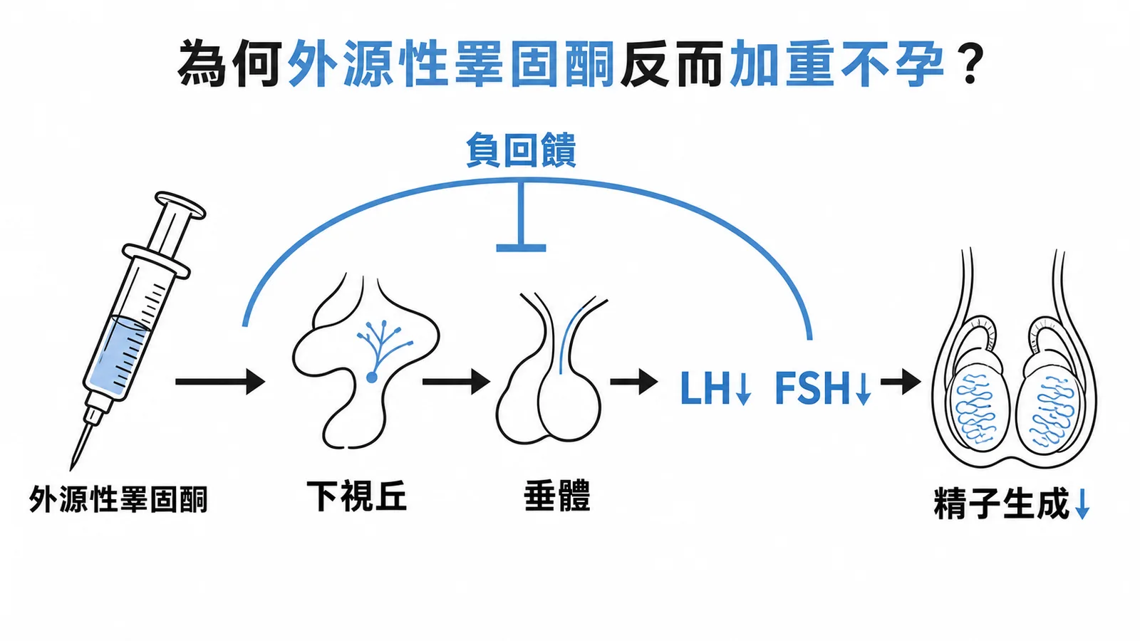 外源性睪固酮透過負回饋抑制下視丘-垂體軸使 LH、FSH 下降，精子生成減少反而加重不孕