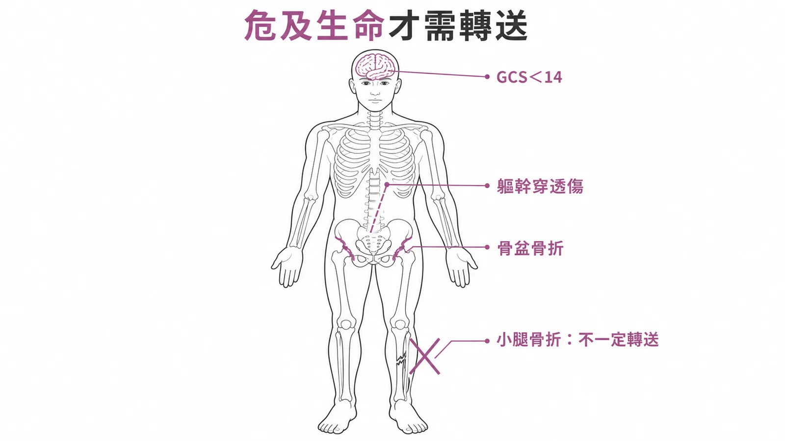 創傷轉送標準：GCS小於14、軀幹穿透傷、骨盆骨折需轉送，小腿骨折不一定需轉送