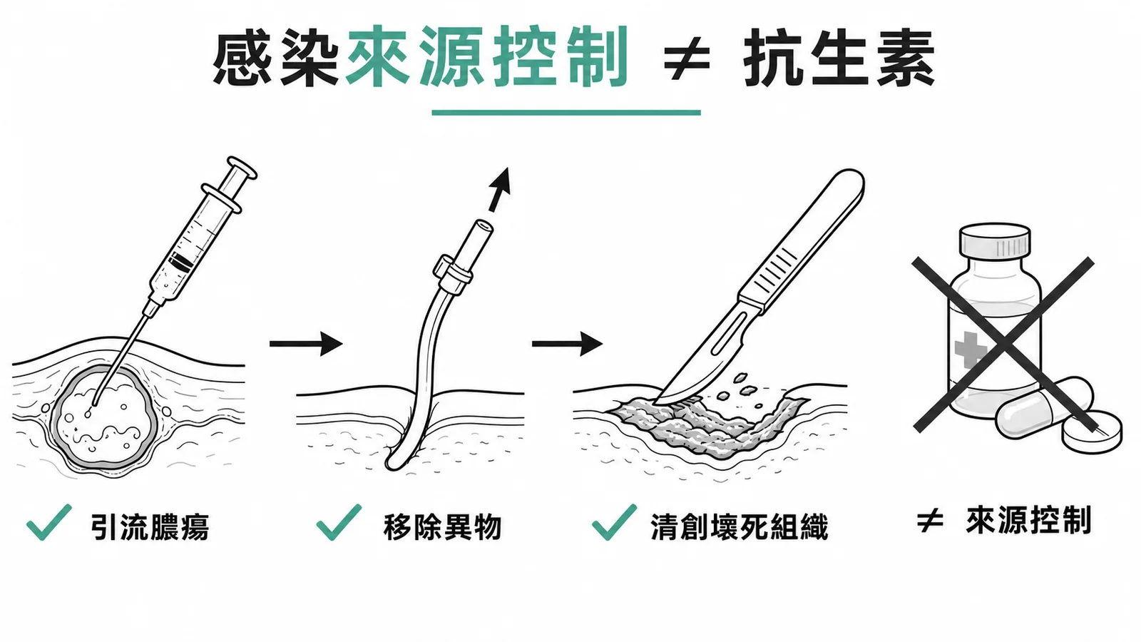 感染來源控制三要素：引流、移除異物、清創，抗生素不算來源控制