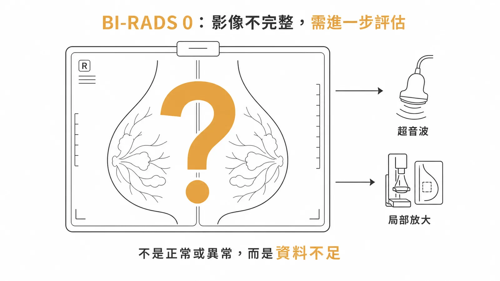 BI-RADS 0代表影像資料不足需進一步評估的示意圖