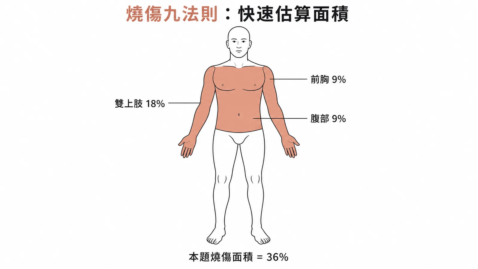 燒傷九法則標示雙上肢前胸腹部共36%的人體示意圖