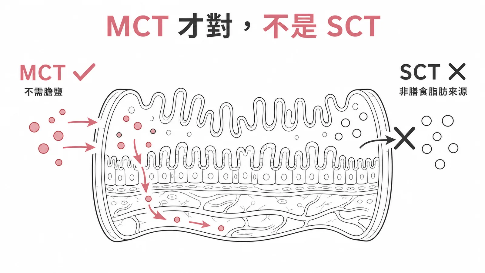 短腸症候群應選MCT中鏈脂肪而非SCT