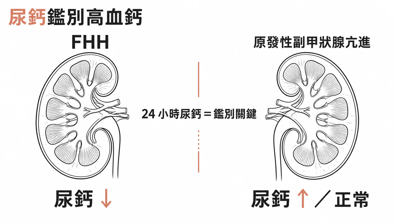 24小時尿鈣鑑別FHH與原發性副甲狀腺功能亢進