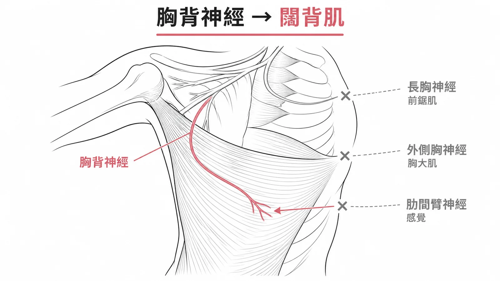 腋下廓清術中胸背神經支配闊背肌的解剖示意圖
