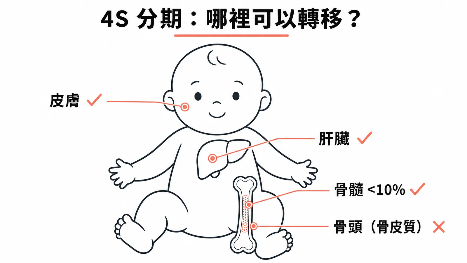 神經母細胞瘤4S分期允許與禁止的轉移部位示意圖