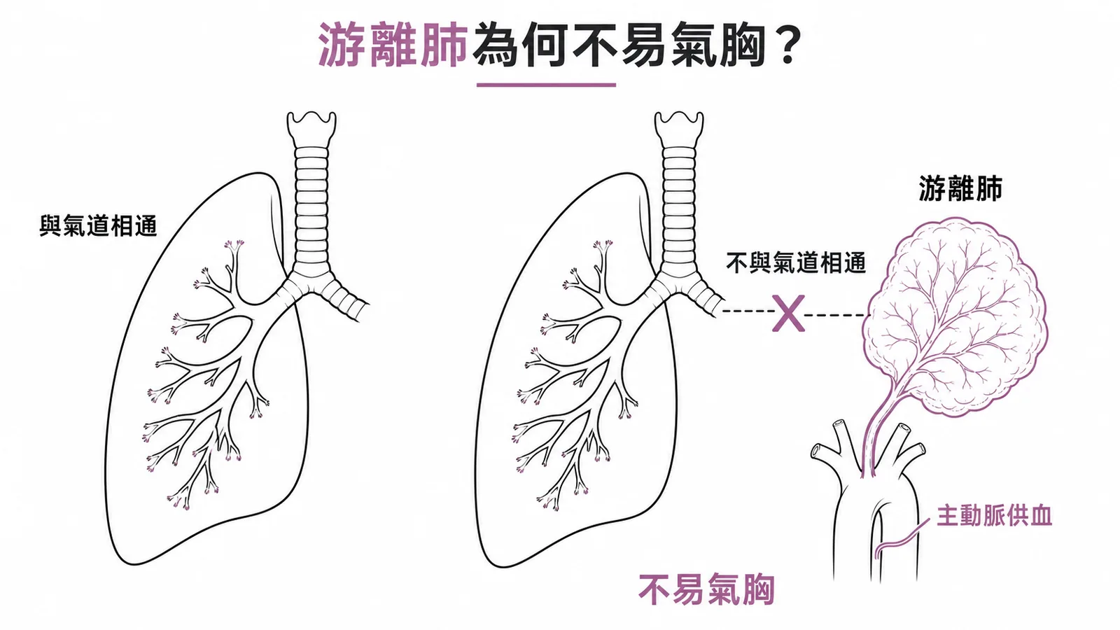游離肺不與氣道相通因此不易氣胸的示意圖