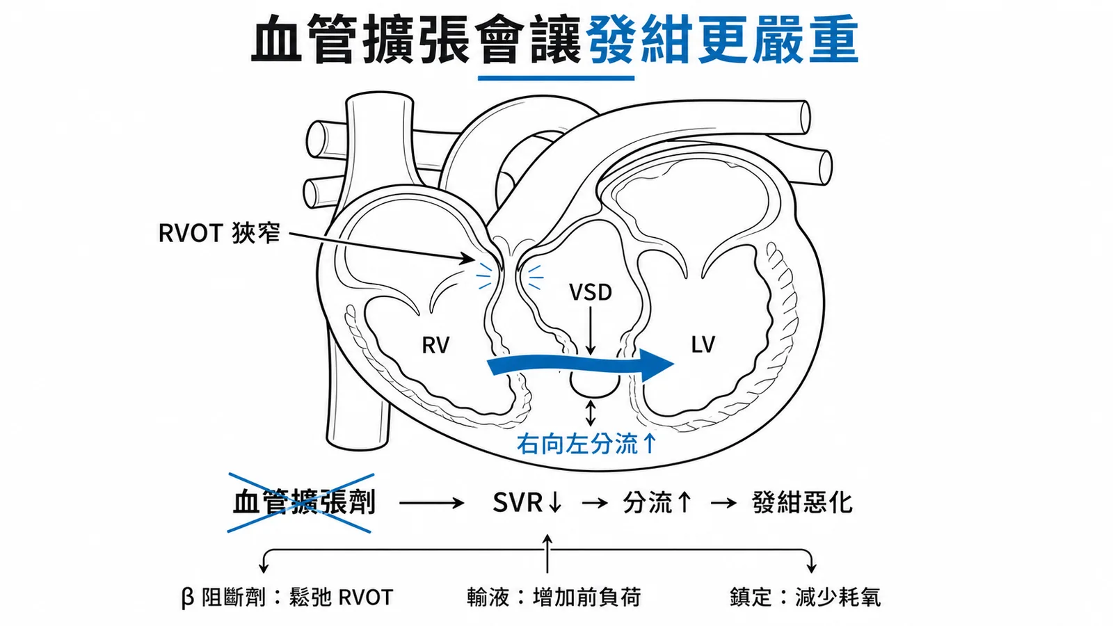 TOF發紺發作：血管擴張劑降低SVR加劇右向左分流使發紺惡化