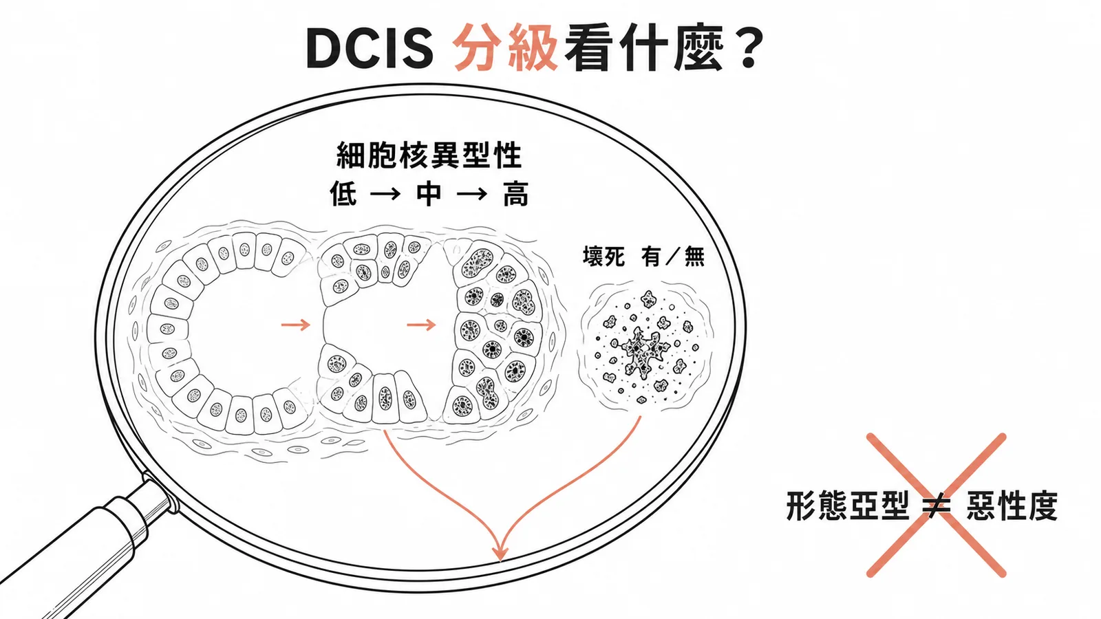 DCIS分級依據是細胞核異型性與壞死程度，形態亞型(comedo/papillary/solid/cribriform)不等於惡性度