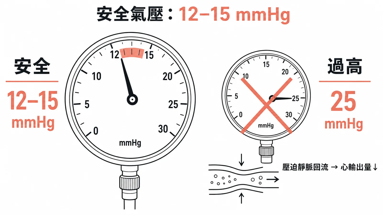 腹腔鏡安全氣壓為12-15 mmHg，25 mmHg過高會影響心輸出量