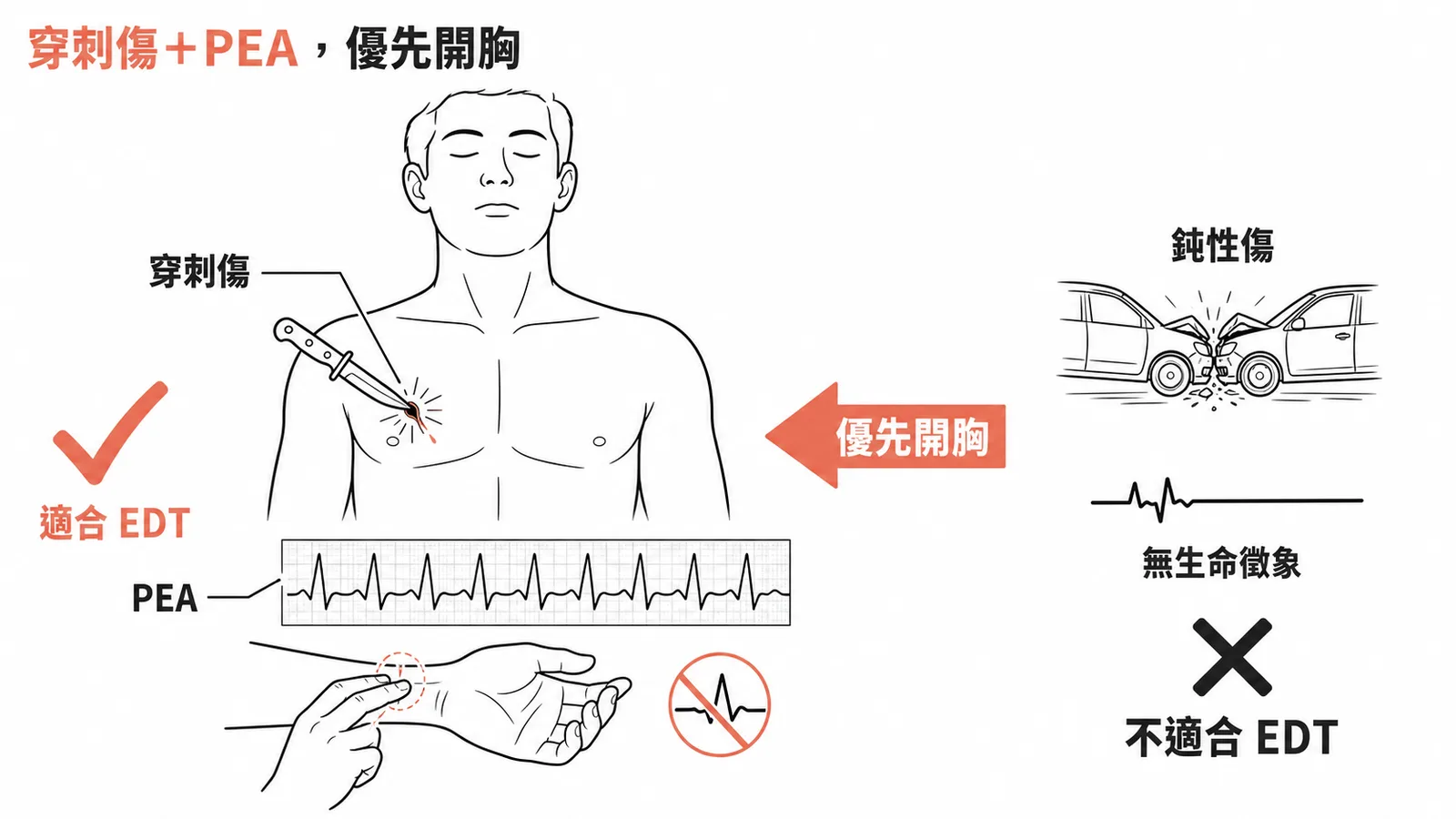 EDT適應症：穿刺傷＋PEA優先開胸，鈍性傷無生命徵象則不適合