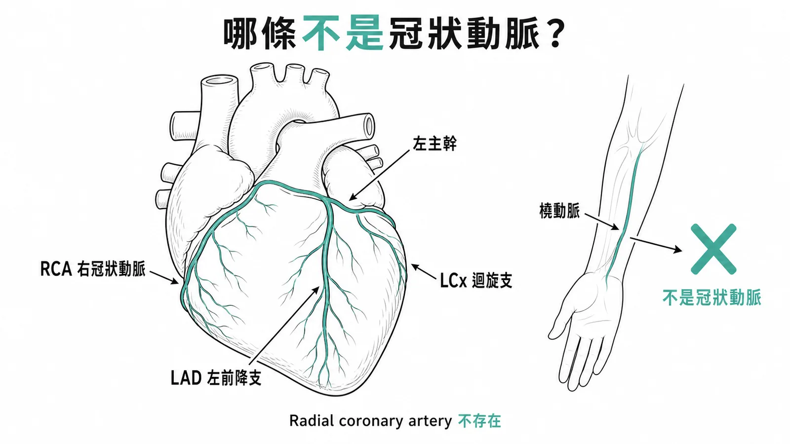 冠狀動脈分支示意圖與橈動脈非冠狀動脈