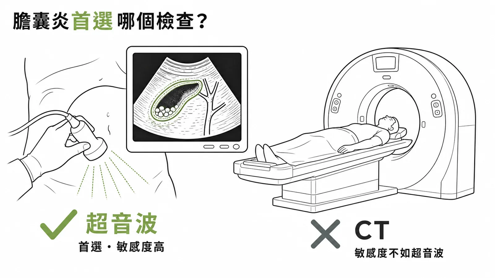 急性膽囊炎首選超音波而非電腦斷層診斷