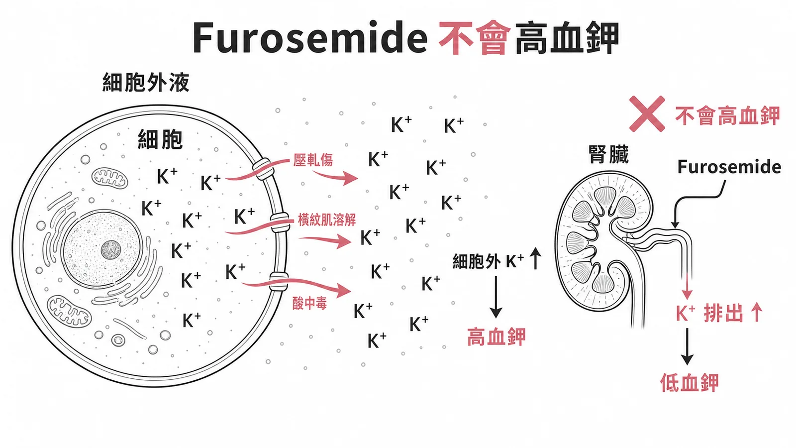 高血鉀常見原因對照圖,壓軋傷、橫紋肌溶解、敗血症致高血鉀,Furosemide 反而造成低血鉀