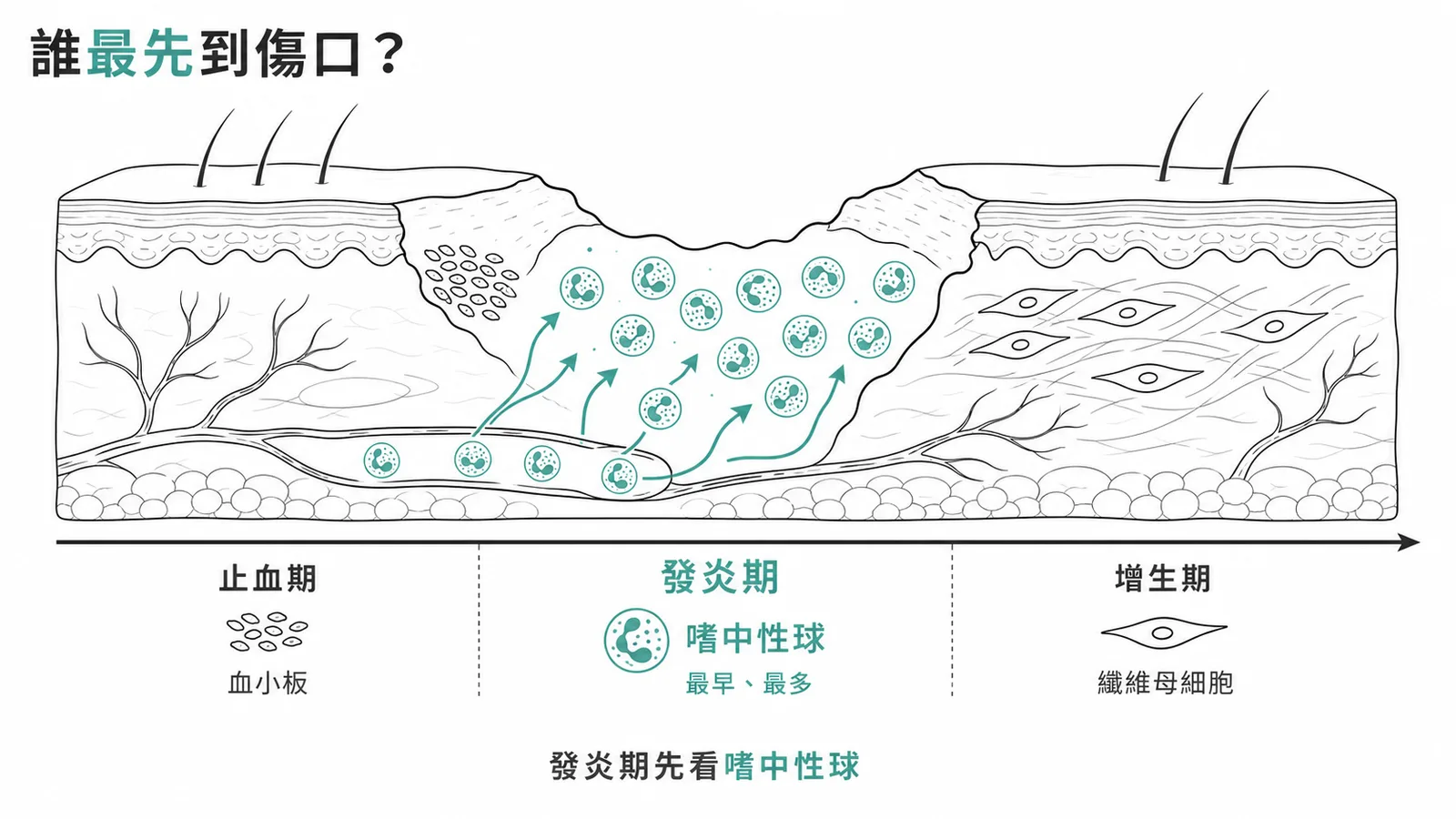 傷口癒合發炎期嗜中性球最先到達示意圖,箭頭依序帶出巨噬細胞與纖維母細胞