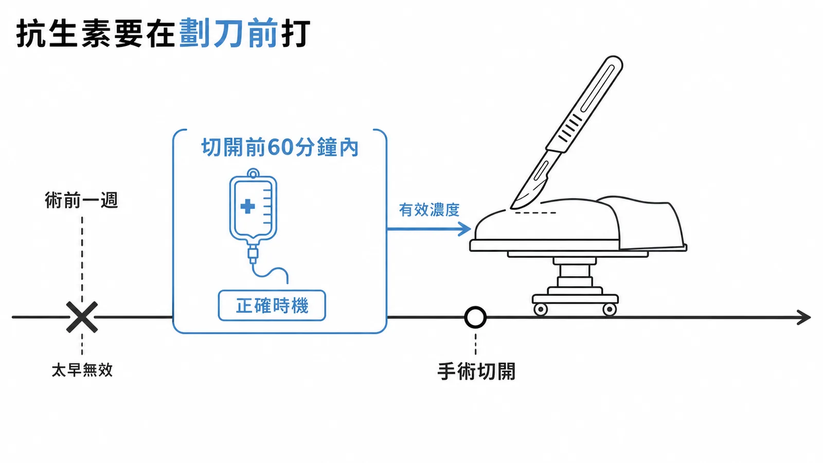 預防性抗生素正確施打時機示意圖,手術切開前 60 分鐘內給予,術前一週打太早無效