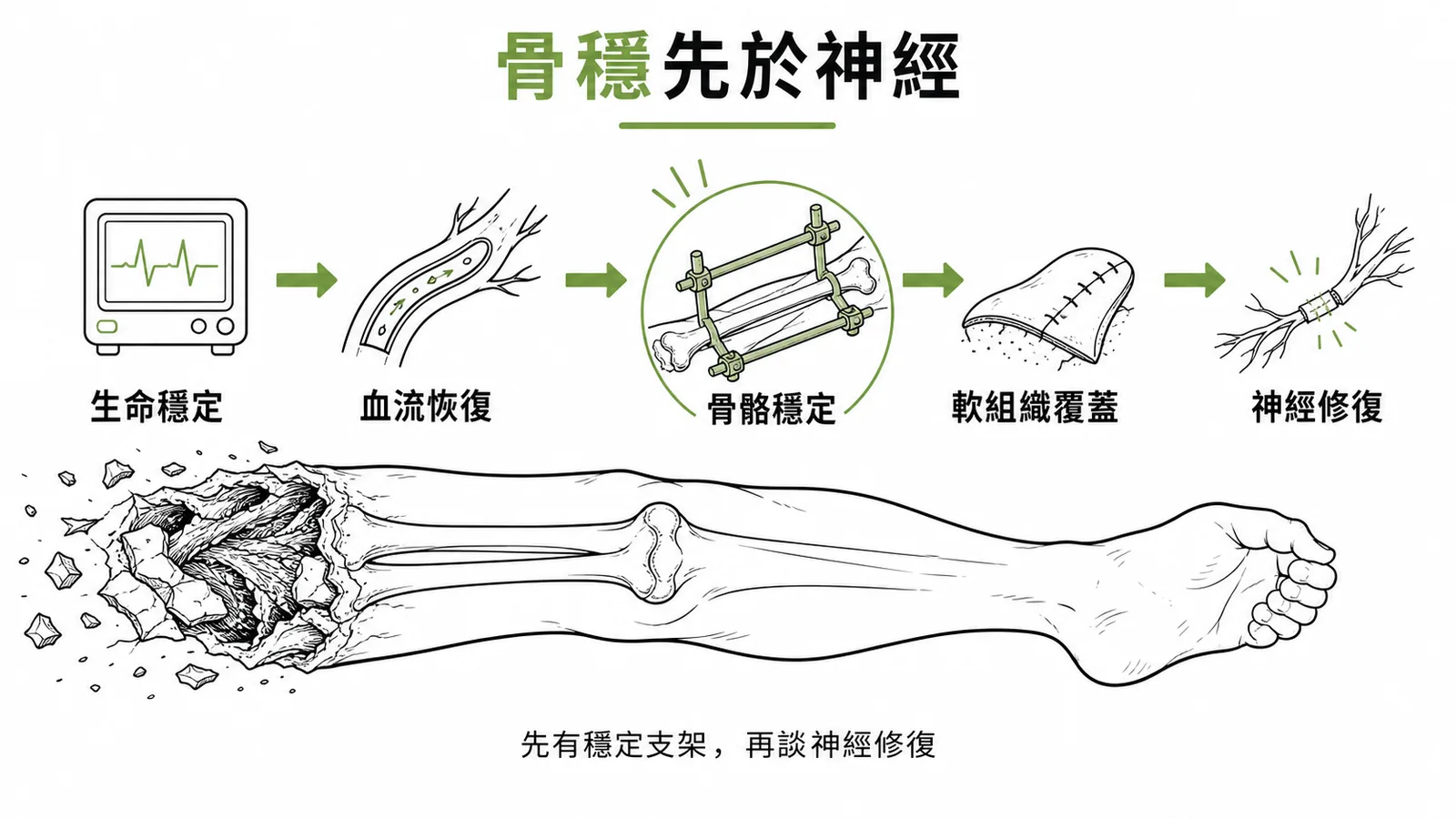 碾壓肢體處理優先順序:先救命再救肢