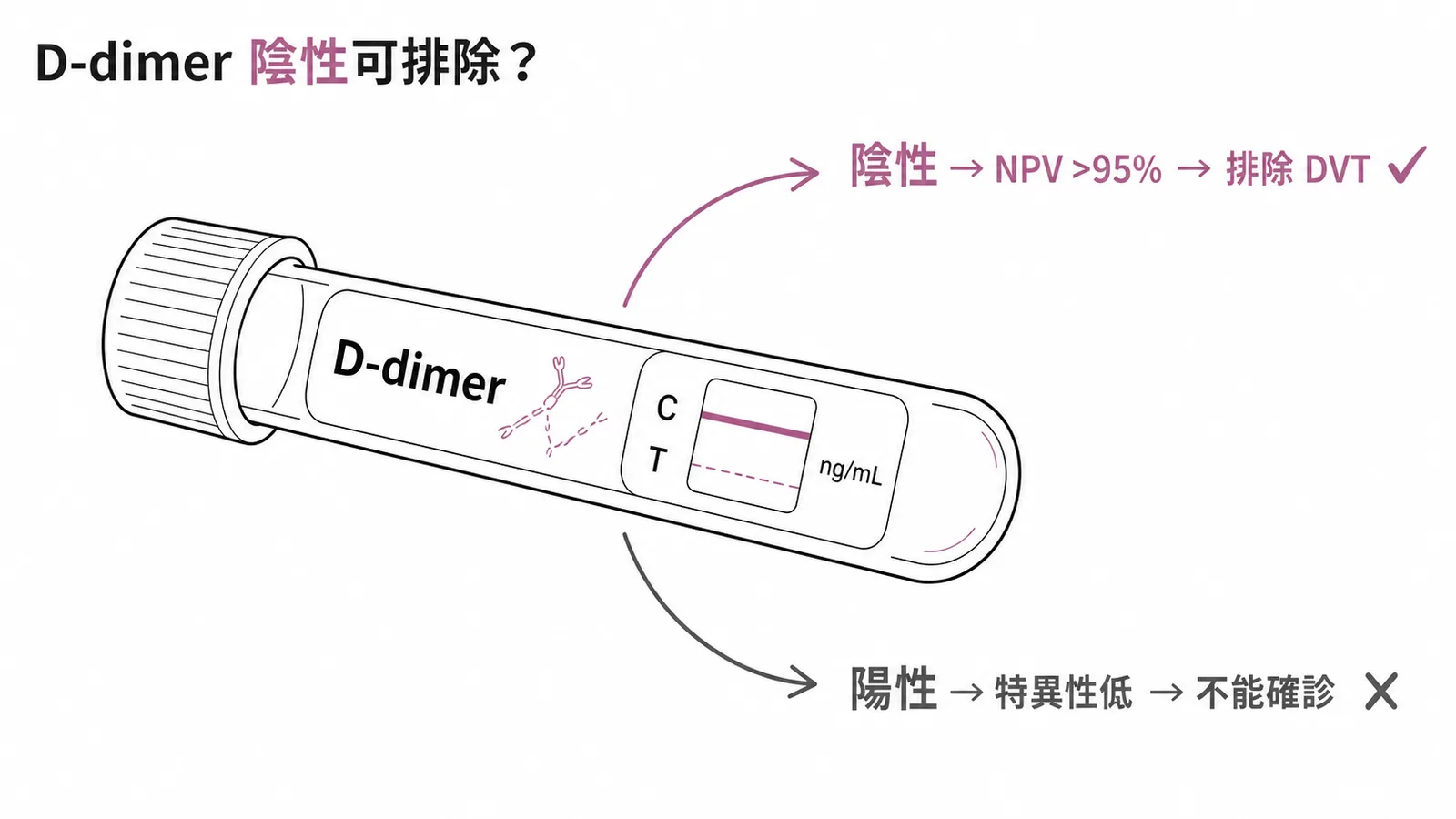 D-dimer陰性預測值高於95%可排除DVT