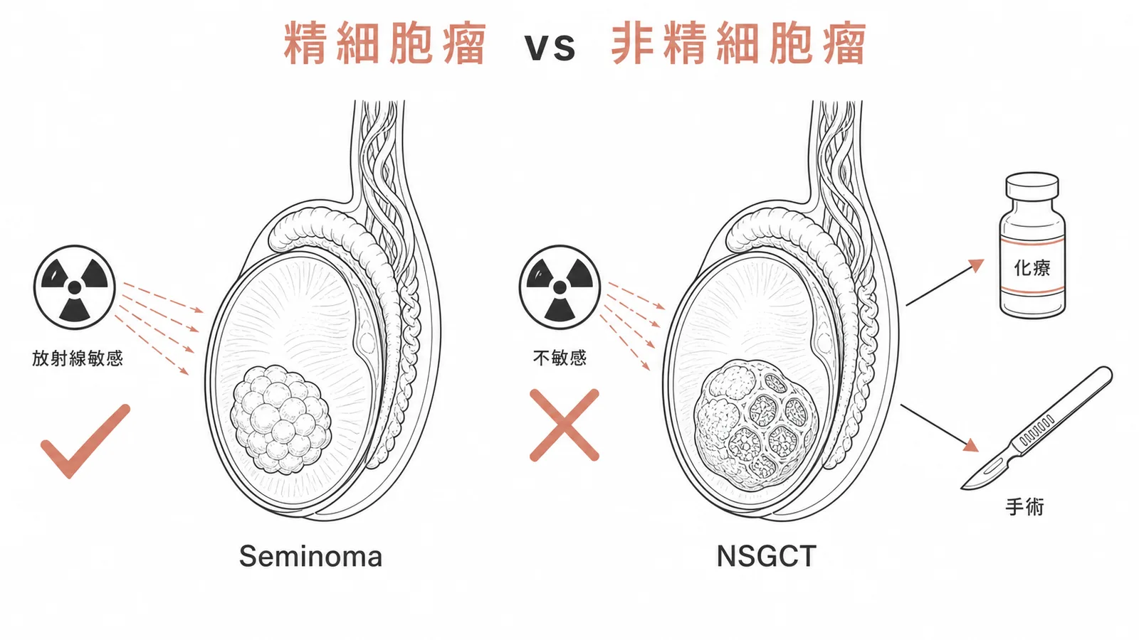 精細胞瘤與非精細胞瘤治療差異對照