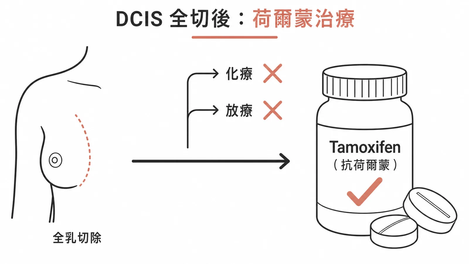 DCIS荷爾蒙受體陽性術後給予Tamoxifen示意
