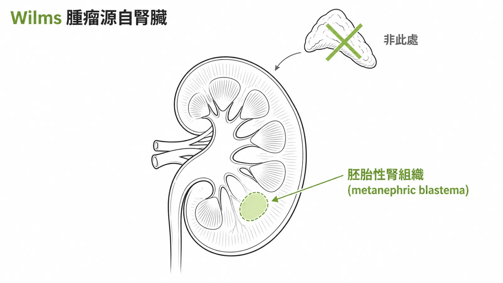 威爾姆氏腫瘤源自腎臟胚胎組織而非腎上腺