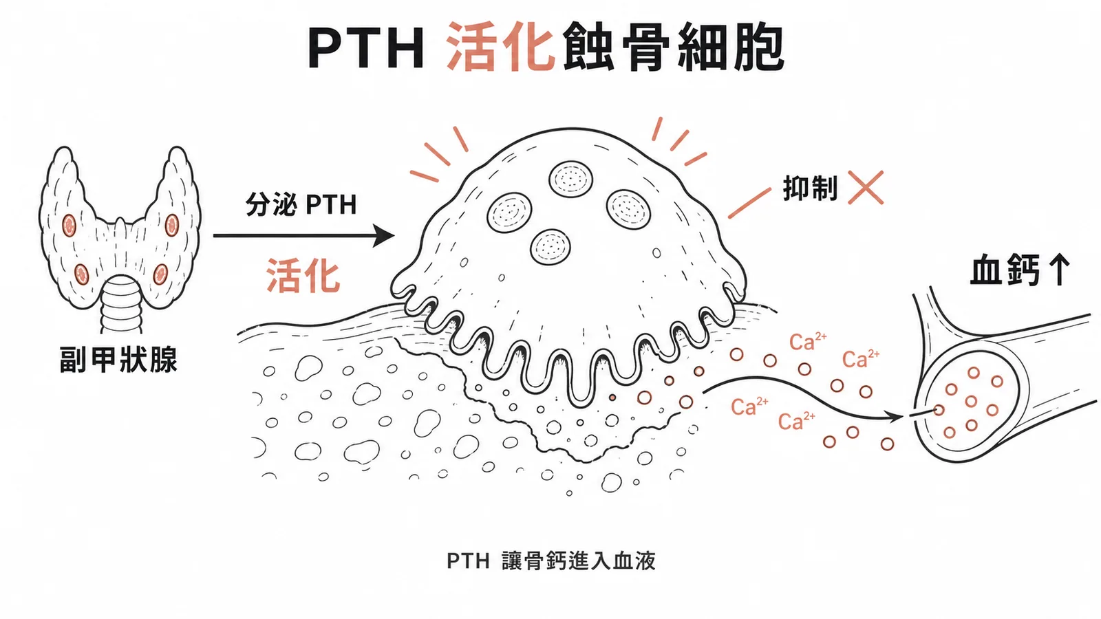 副甲狀腺素活化蝕骨細胞促進骨質分解示意圖