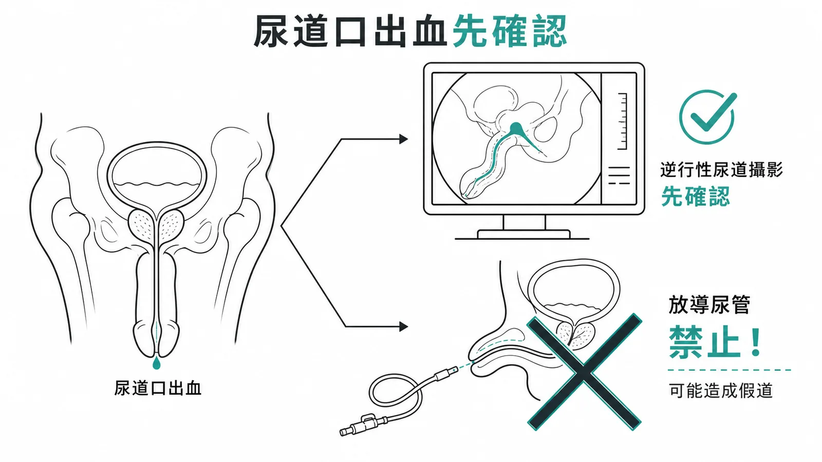 尿道口出血時禁放導尿管
