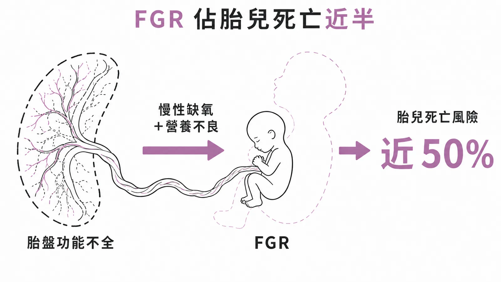 FGR 致死機轉:胎盤功能不全→慢性缺氧→生長受限,佔胎兒死亡近 50%