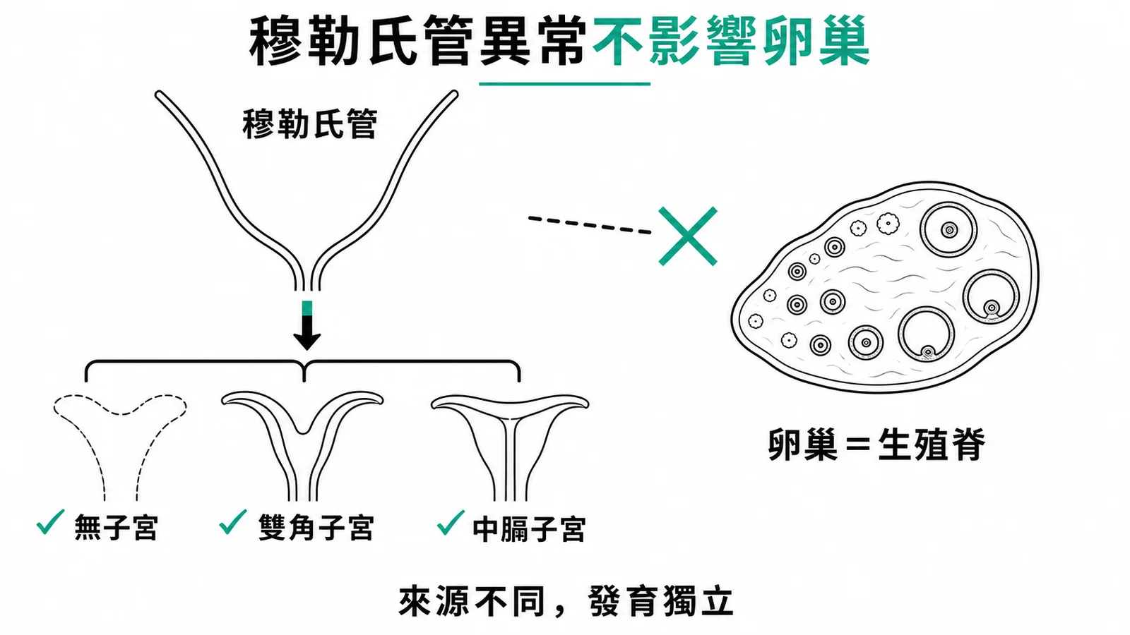 穆勒氏管異常影響子宮但不影響卵巢,兩者發育來源獨立