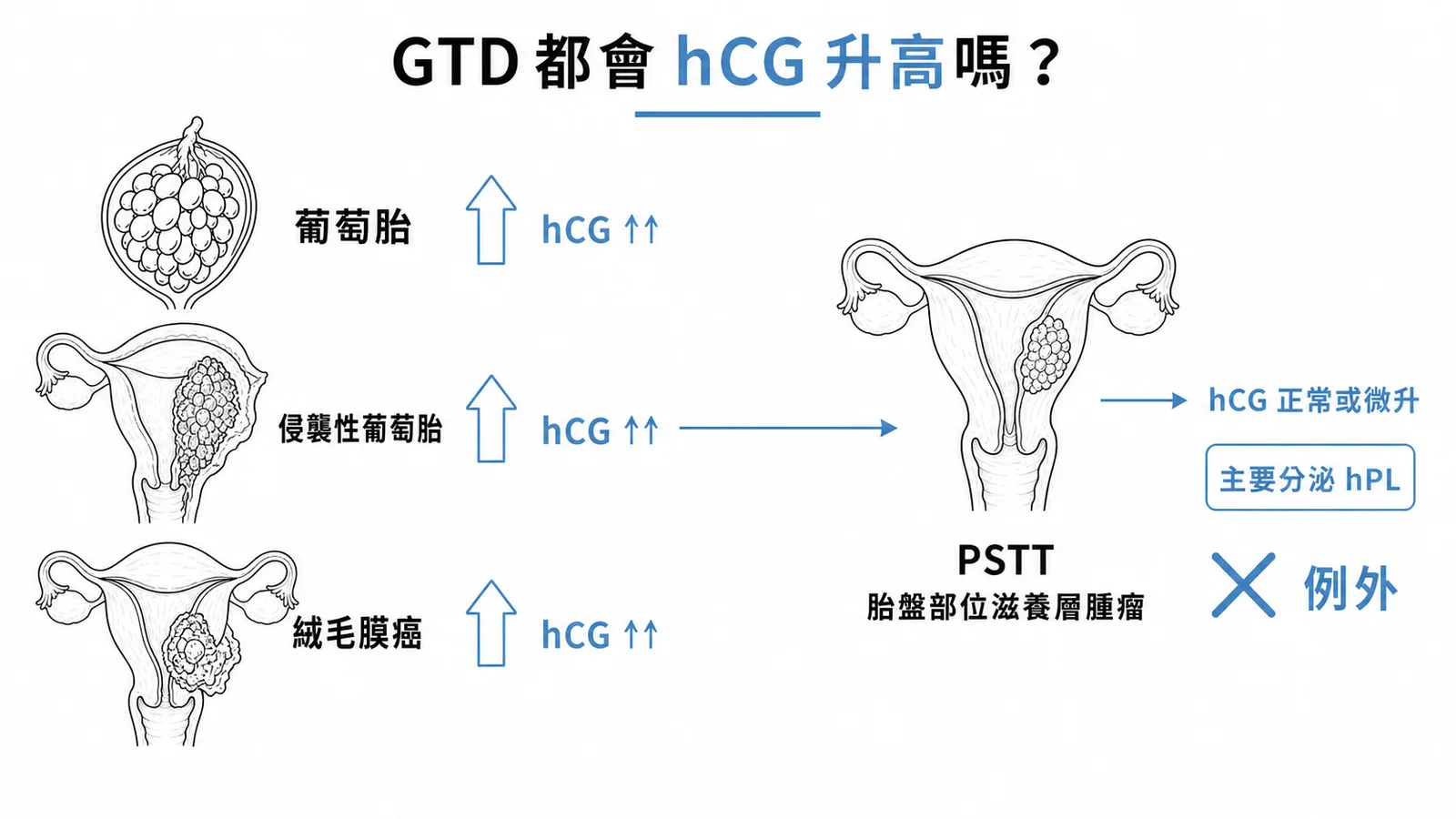 GTD各型態與hCG關係:葡萄胎、侵襲性葡萄胎、絨毛膜癌hCG明顯升高,PSTT為例外主要分泌hPL