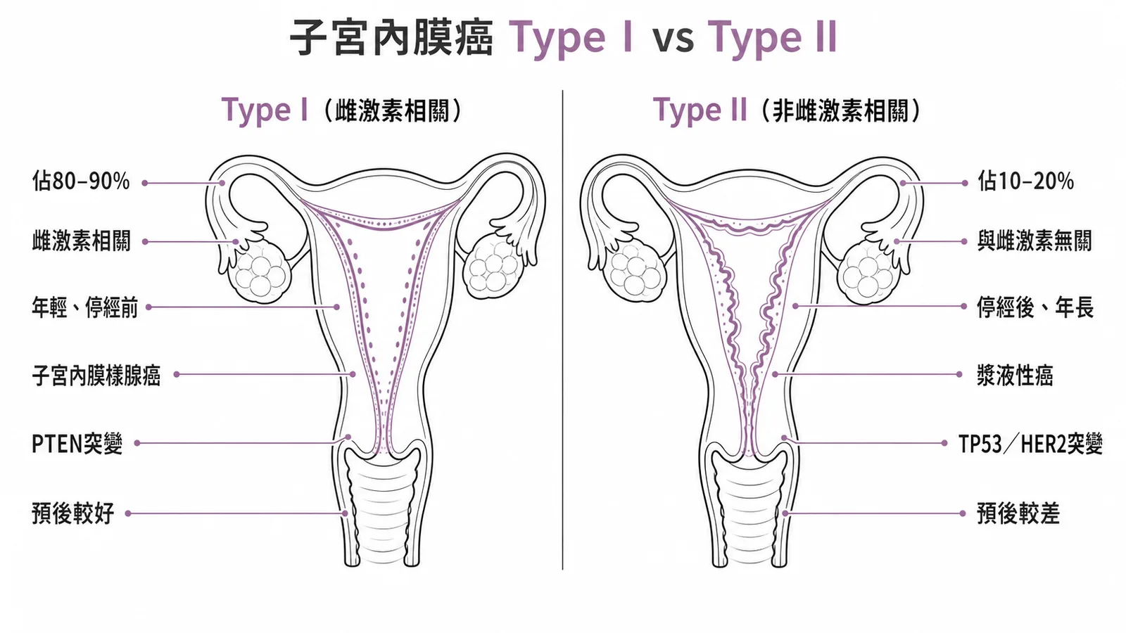 子宮內膜癌Type I與Type II對照:雌激素相關性、年齡、組織型態、基因突變與預後差異