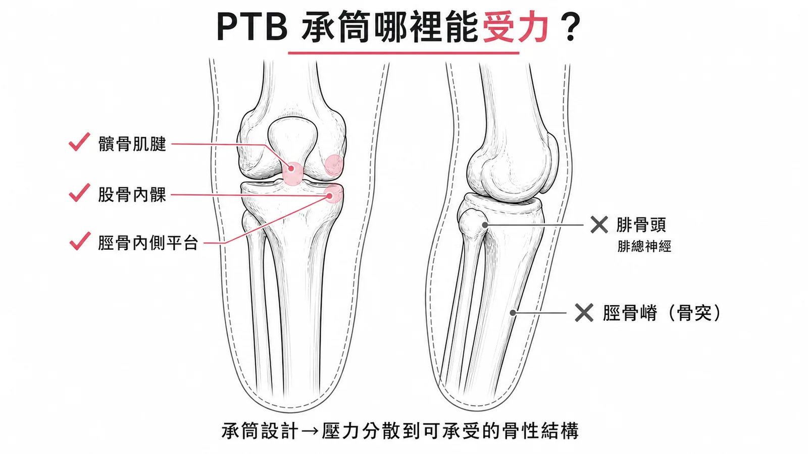 PTB承筒壓力分布:可承受區與敏感區標示