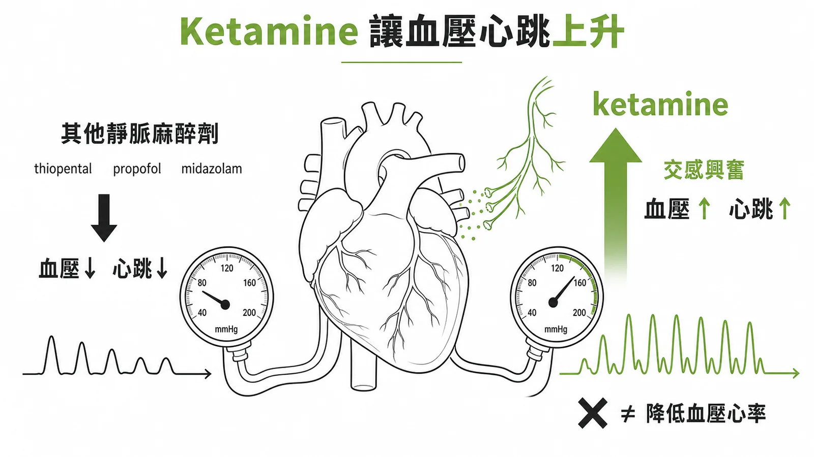 Ketamine 獨特的交感興奮作用：血壓心跳上升，與其他靜脈麻醉劑相反