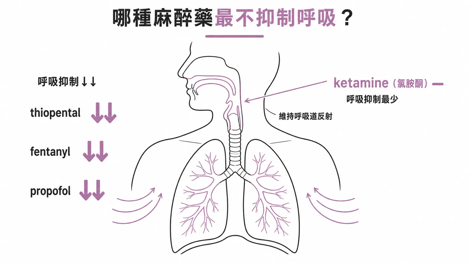Ketamine 是對呼吸抑制最少的靜脈麻醉劑,能維持呼吸道反射
